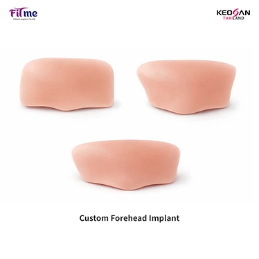 Vật liệu cấy ghép trán FITme — Custom Forehead Implant