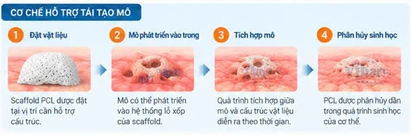 Illustration of scaffold placement, tissue ingrowth, integration and biodegradation